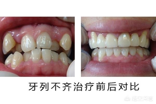 宣威最新24小时牙医在线咨询方法分析(最方便真实的宣威有没有24小时牙医方法)