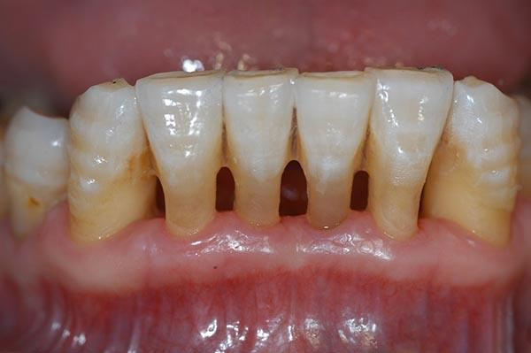 宣威最新24小时牙医在线咨询方法分析(最方便真实的宣威有没有24小时牙医方法)